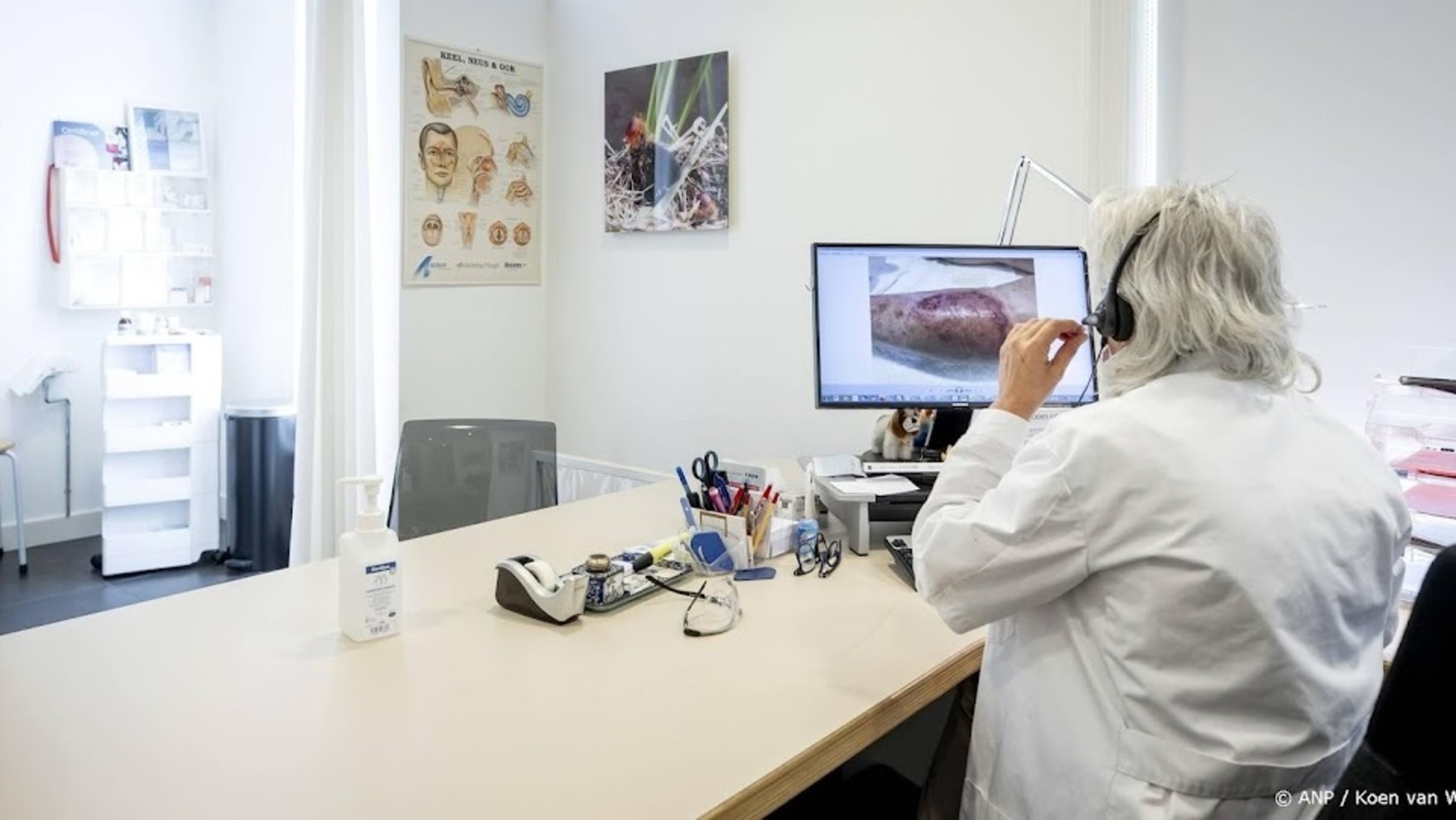 LHV: GPs using ChipSoft must report to the Dutch Data Protection Authority