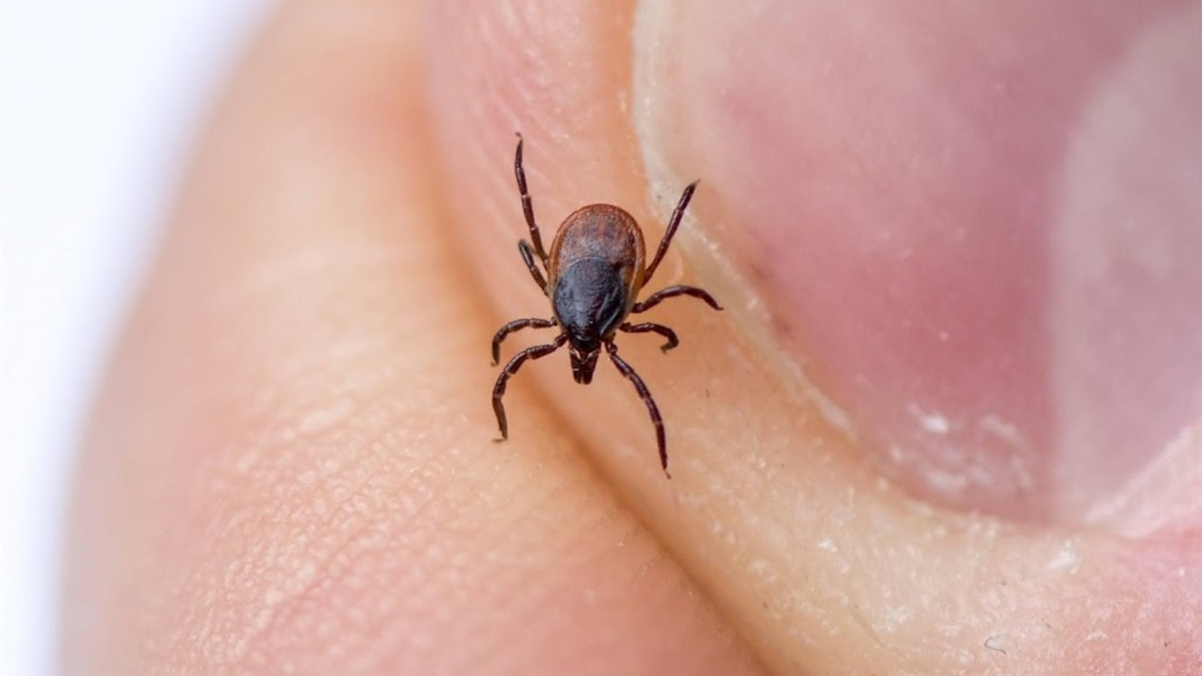 RIVM saw sharp rise in tick bites last year: what's causing the increase?