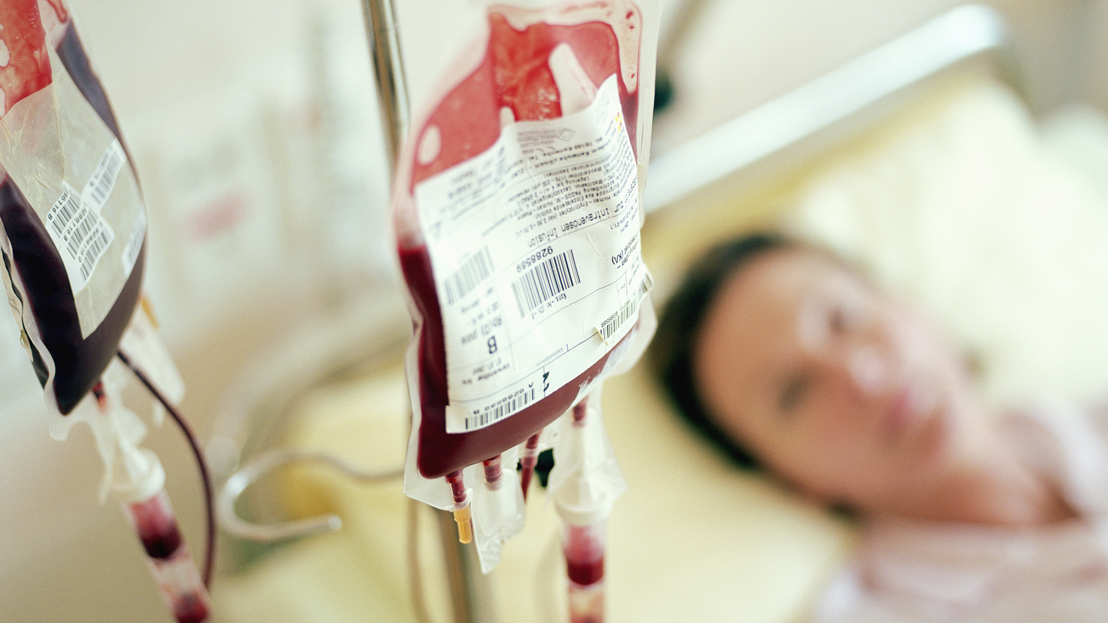 Jehovah’s Witnesses now allowed to use their own blood in medical procedures. Is it of any use to them?