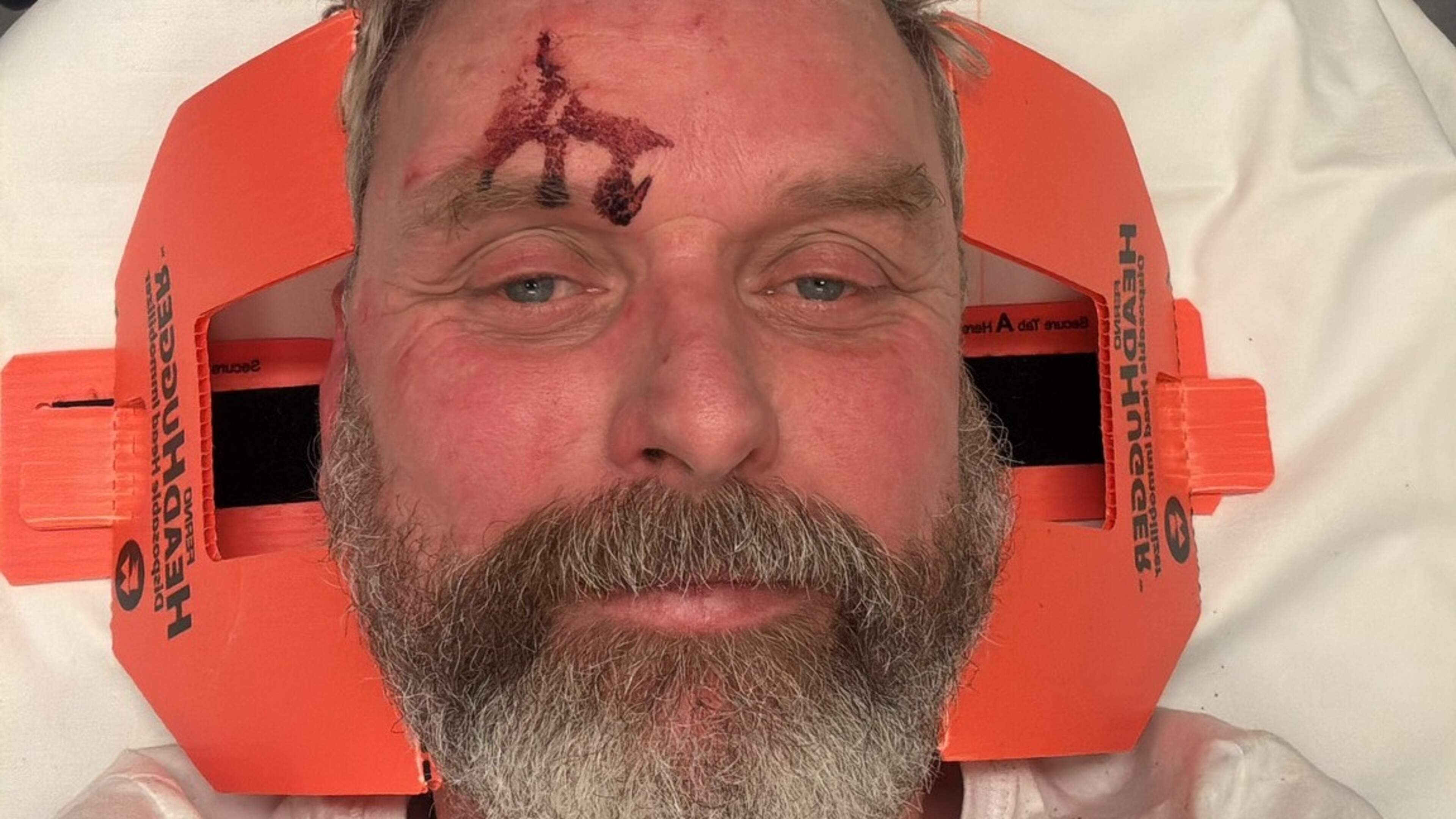 Ton (56) brutally beaten in Snapchat 'jumping' trend: 'Like being attacked by a pack of hyenas'